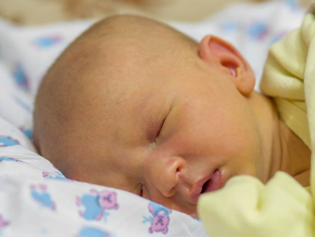 Yeni Doğan Bebeklerde Sarılık Nasıl Önlenir?